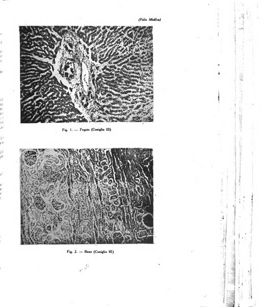 Folia medica periodico trimensile di patologia e clinica medica