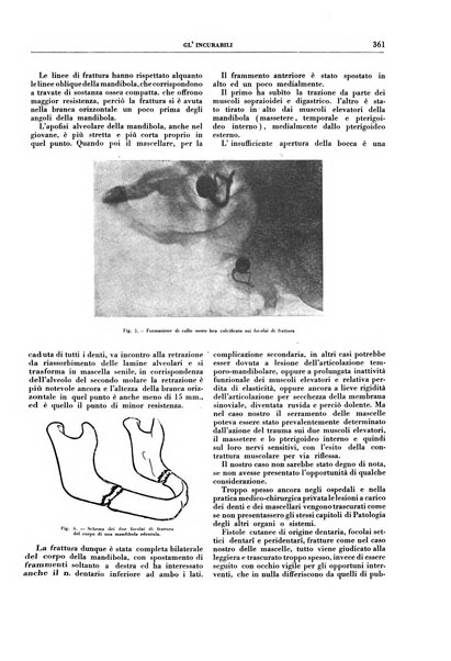 Gli incurabili periodico mensile di medicina, chirurgia, specialità, igiene e vita ospedaliera