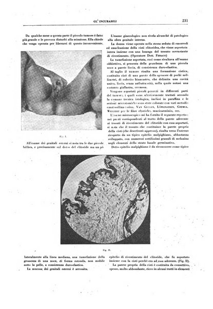 Gli incurabili periodico mensile di medicina, chirurgia, specialità, igiene e vita ospedaliera