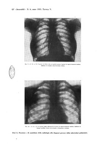 Gli incurabili periodico mensile di medicina, chirurgia, specialità, igiene e vita ospedaliera