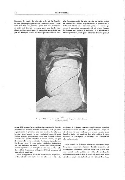 Gli incurabili periodico mensile di medicina, chirurgia, specialità, igiene e vita ospedaliera