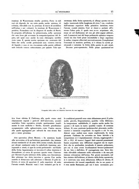 Gli incurabili periodico mensile di medicina, chirurgia, specialità, igiene e vita ospedaliera