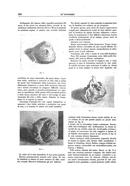 Gli incurabili periodico mensile di medicina, chirurgia, specialità, igiene e vita ospedaliera