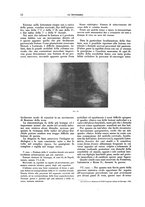 giornale/CFI0356210/1938/unico/00000020