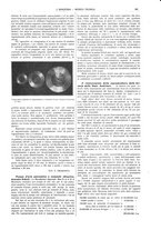 giornale/CFI0356408/1914/unico/00000363