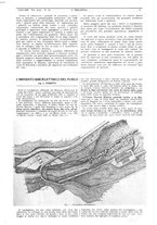 giornale/CFI0356408/1929/unico/00000011