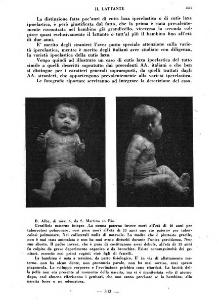 Il lattante periodico mensile di fisiopatologia, igiene e difesa sociale del bambino nel primo biennio di vita