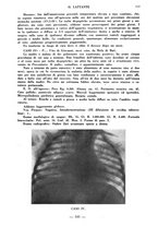 giornale/CFI0357229/1937/unico/00000785