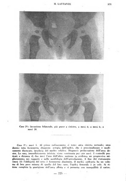 Il lattante periodico mensile di fisiopatologia, igiene e difesa sociale del bambino nel primo biennio di vita