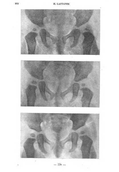 Il lattante periodico mensile di fisiopatologia, igiene e difesa sociale del bambino nel primo biennio di vita