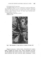 giornale/CFI0358170/1933/unico/00000305