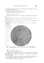 giornale/CFI0358170/1933/unico/00000645