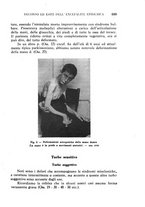 giornale/CFI0358170/1933/unico/00000745