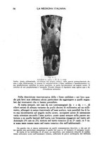 giornale/CFI0358170/1937/unico/00000084