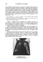 giornale/CFI0358170/1938/unico/00000790