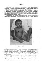 giornale/CFI0358170/1941/unico/00000277