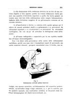 giornale/CFI0358174/1933/unico/00000325