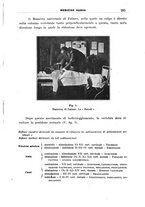 giornale/CFI0358174/1933/unico/00000327