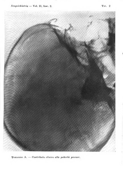 Neopsichiatria rassegna di psichiatria, neurologia, endocrinologia