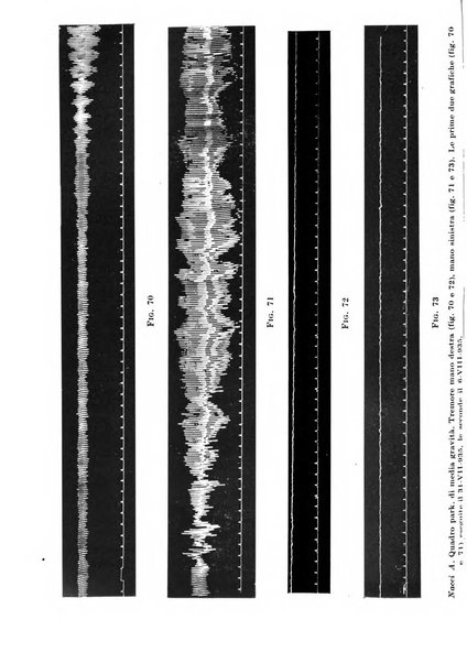 Neopsichiatria rassegna di psichiatria, neurologia, endocrinologia