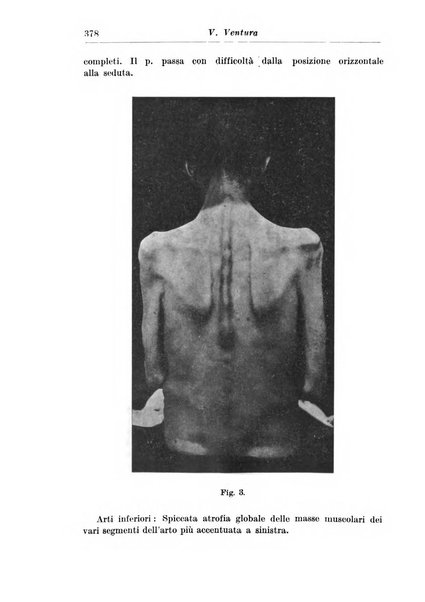 Neopsichiatria rassegna di psichiatria, neurologia, endocrinologia