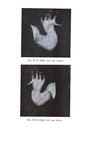 Neopsichiatria rassegna di psichiatria, neurologia, endocrinologia