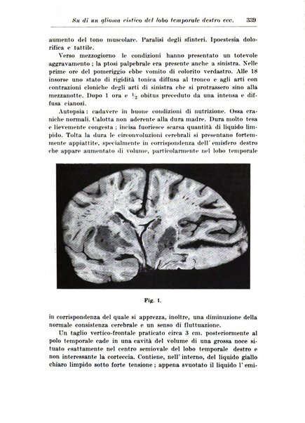 Neopsichiatria rassegna di psichiatria, neurologia, endocrinologia