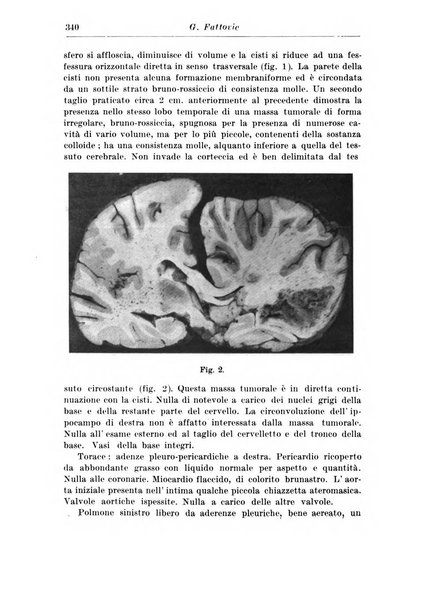 Neopsichiatria rassegna di psichiatria, neurologia, endocrinologia