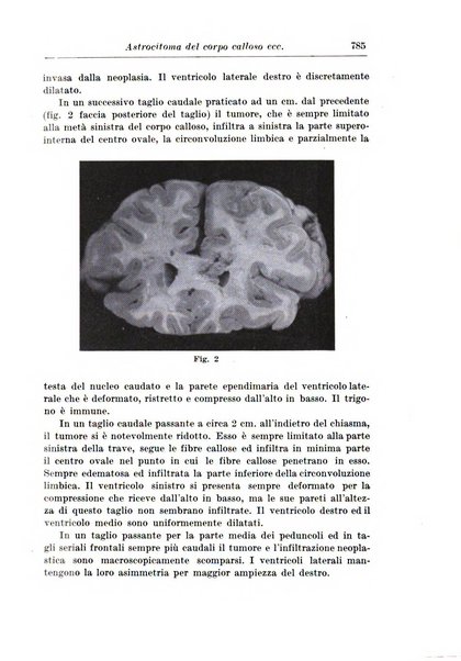 Neopsichiatria rassegna di psichiatria, neurologia, endocrinologia