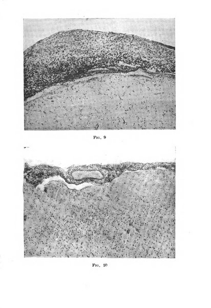 Neopsichiatria rassegna di psichiatria, neurologia, endocrinologia