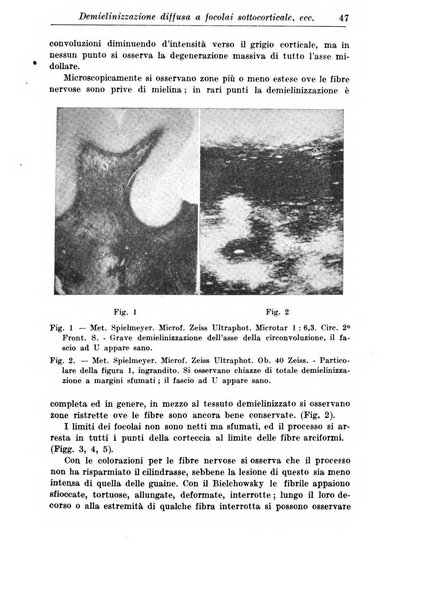 Neopsichiatria rassegna di psichiatria, neurologia, endocrinologia