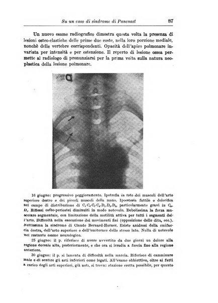 Neopsichiatria rassegna di psichiatria, neurologia, endocrinologia