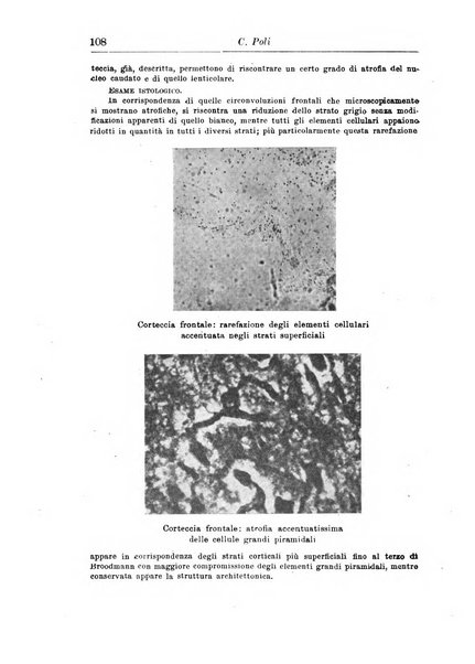 Neopsichiatria rassegna di psichiatria, neurologia, endocrinologia