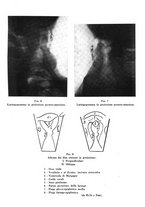 giornale/CFI0359778/1942/unico/00000187