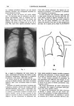 giornale/CFI0360608/1916/unico/00000152