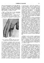 giornale/CFI0360608/1919/unico/00000161