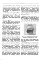 giornale/CFI0360608/1924/unico/00000153
