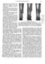 giornale/CFI0360608/1934/unico/00000149
