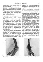giornale/CFI0360608/1934/unico/00000221
