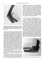 giornale/CFI0360608/1934/unico/00000222