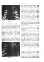 giornale/CFI0360608/1937/unico/00000389