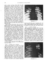 giornale/CFI0360608/1937/unico/00000392