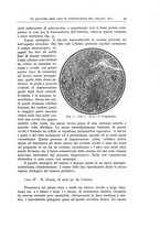 giornale/CFI0360651/1930/unico/00000051