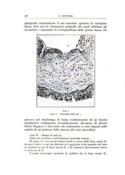 L'oto-rino-laringologia italiana