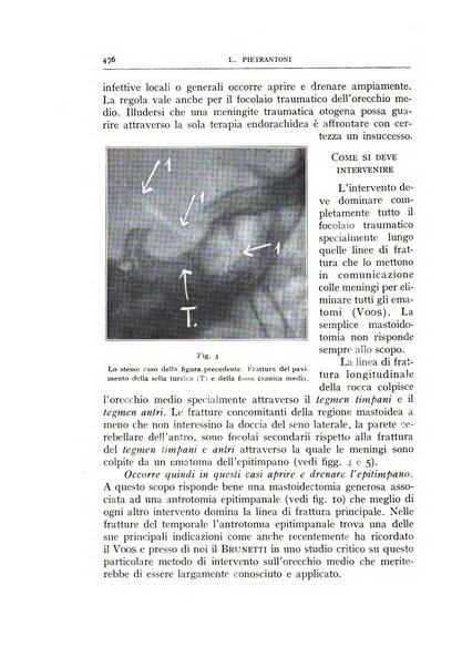 L'oto-rino-laringologia italiana