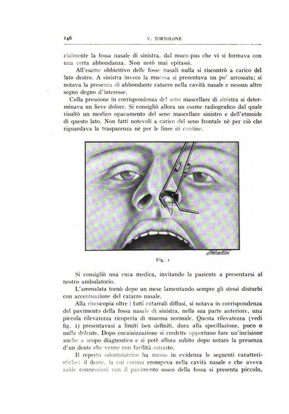 L'oto-rino-laringologia italiana