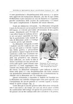 giornale/CFI0360651/1935/unico/00000293