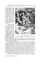 giornale/CFI0360651/1935/unico/00000319