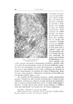 giornale/CFI0360651/1935/unico/00000322