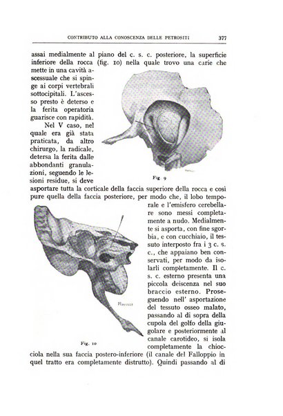 L'oto-rino-laringologia italiana